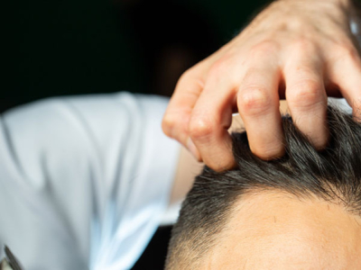 La caída del cabello